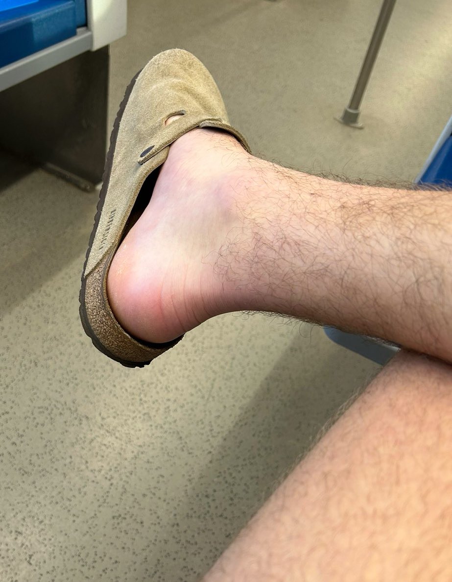 Would you remove my sandal and worship my feet on public transit? #findom #cashmaster #alpha 