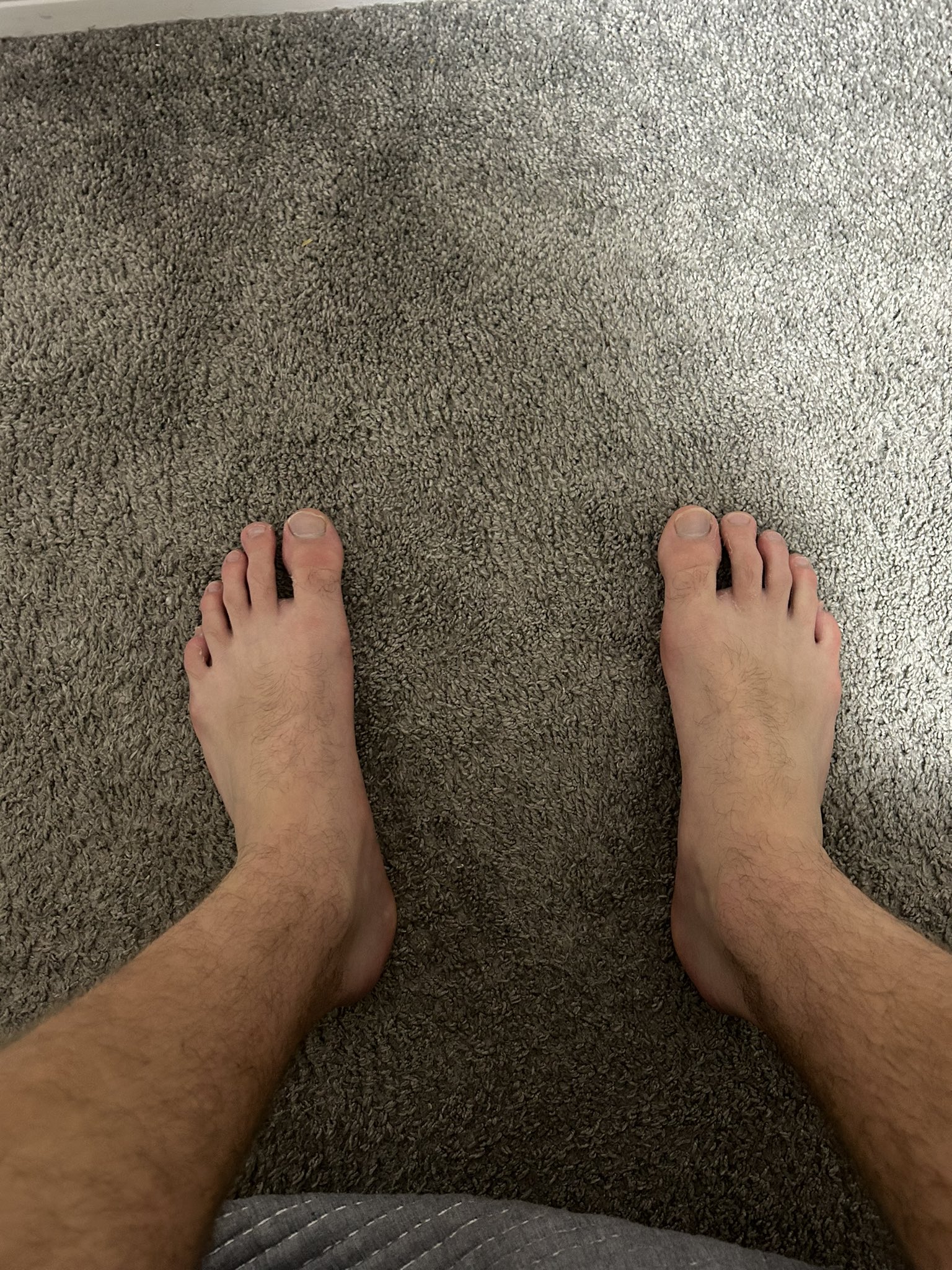 Keep bating you pathetic loser 