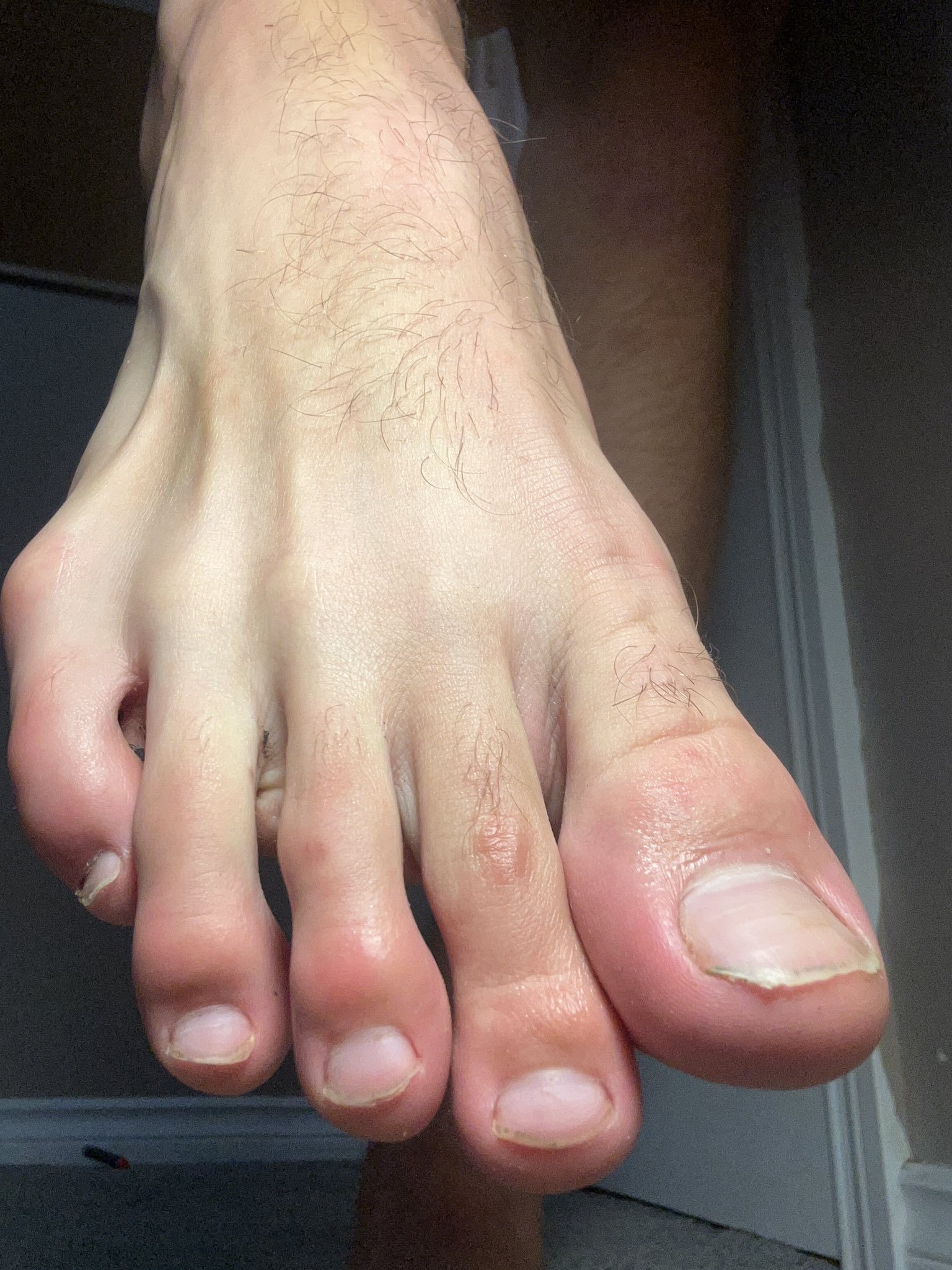 Close up look at my giant alpha toes. If you see anywhere that needs cleaning, get to work! 